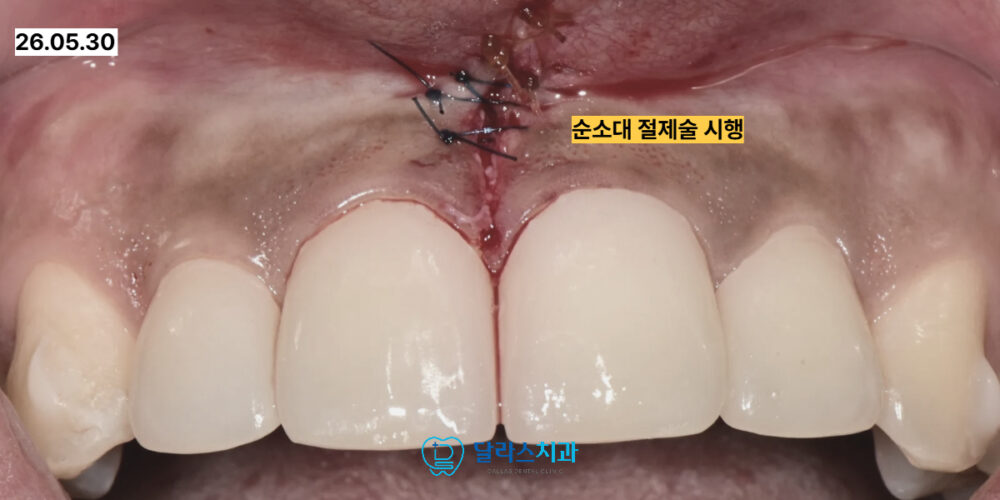 노원치과