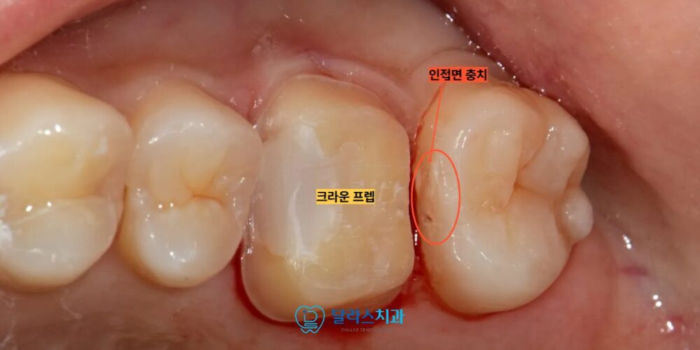 노원치과