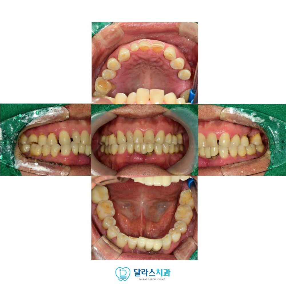 노원역치과