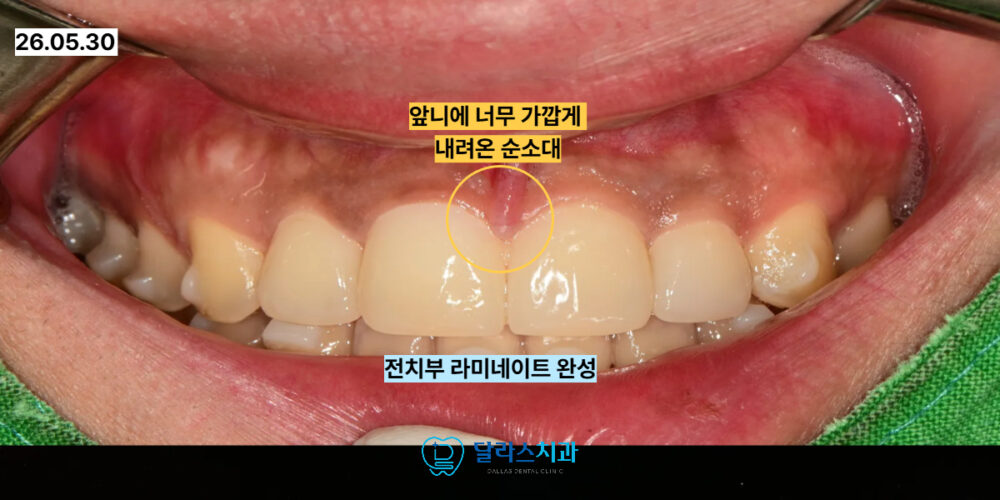노원치과