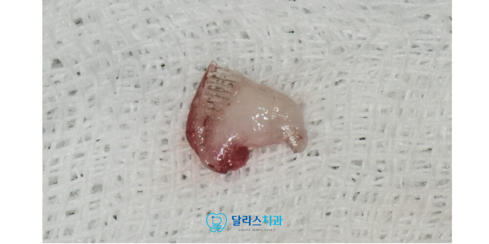 노원치과