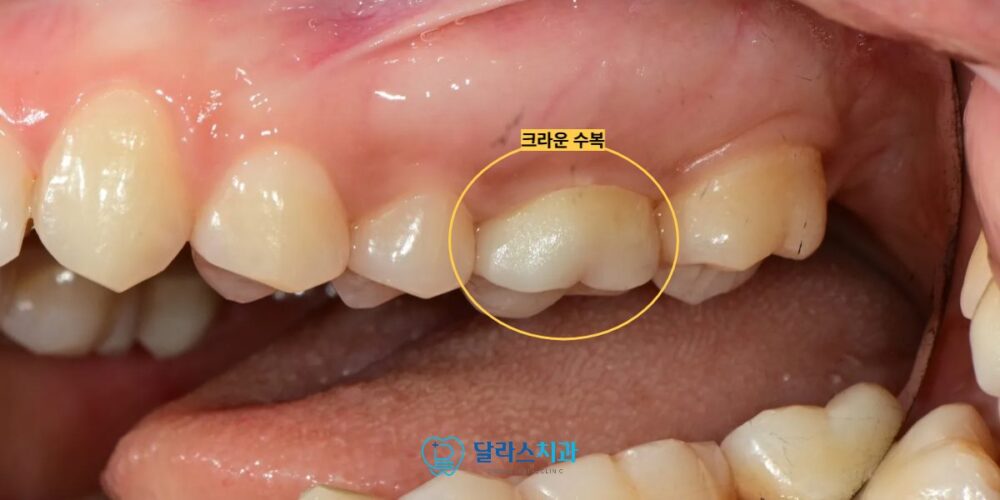 노원치과