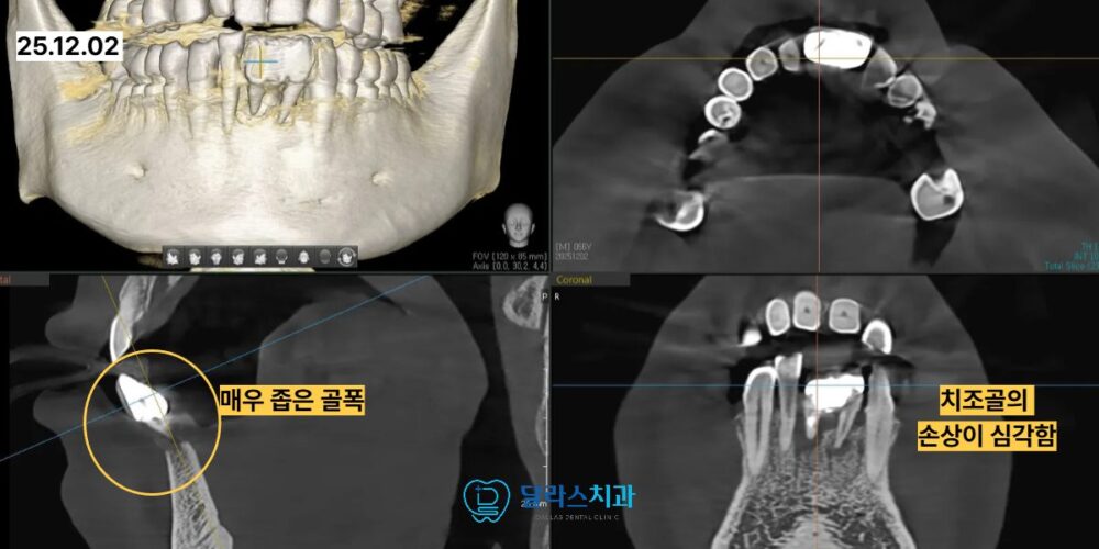 노원역치과