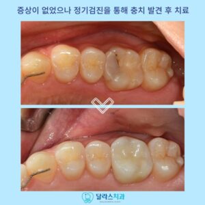 노원치과
