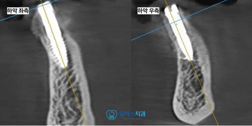 노원역치과