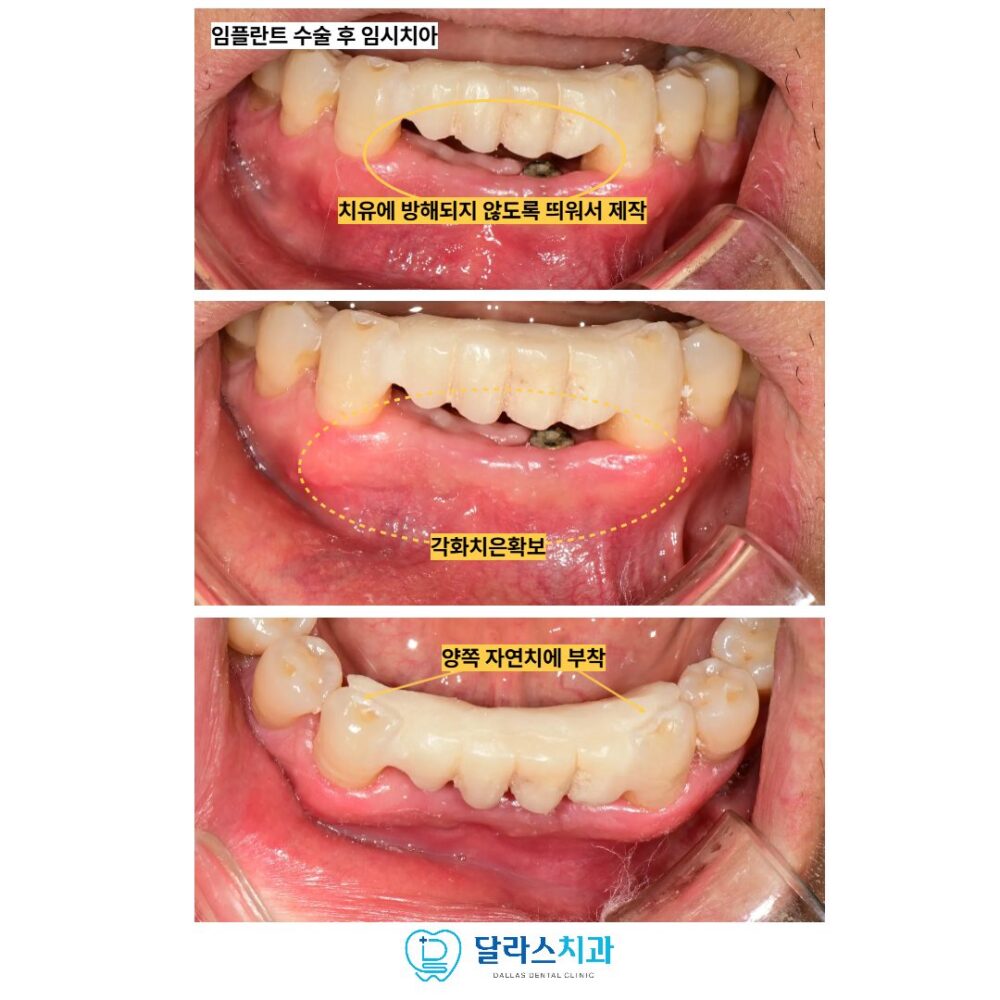 노원역치과