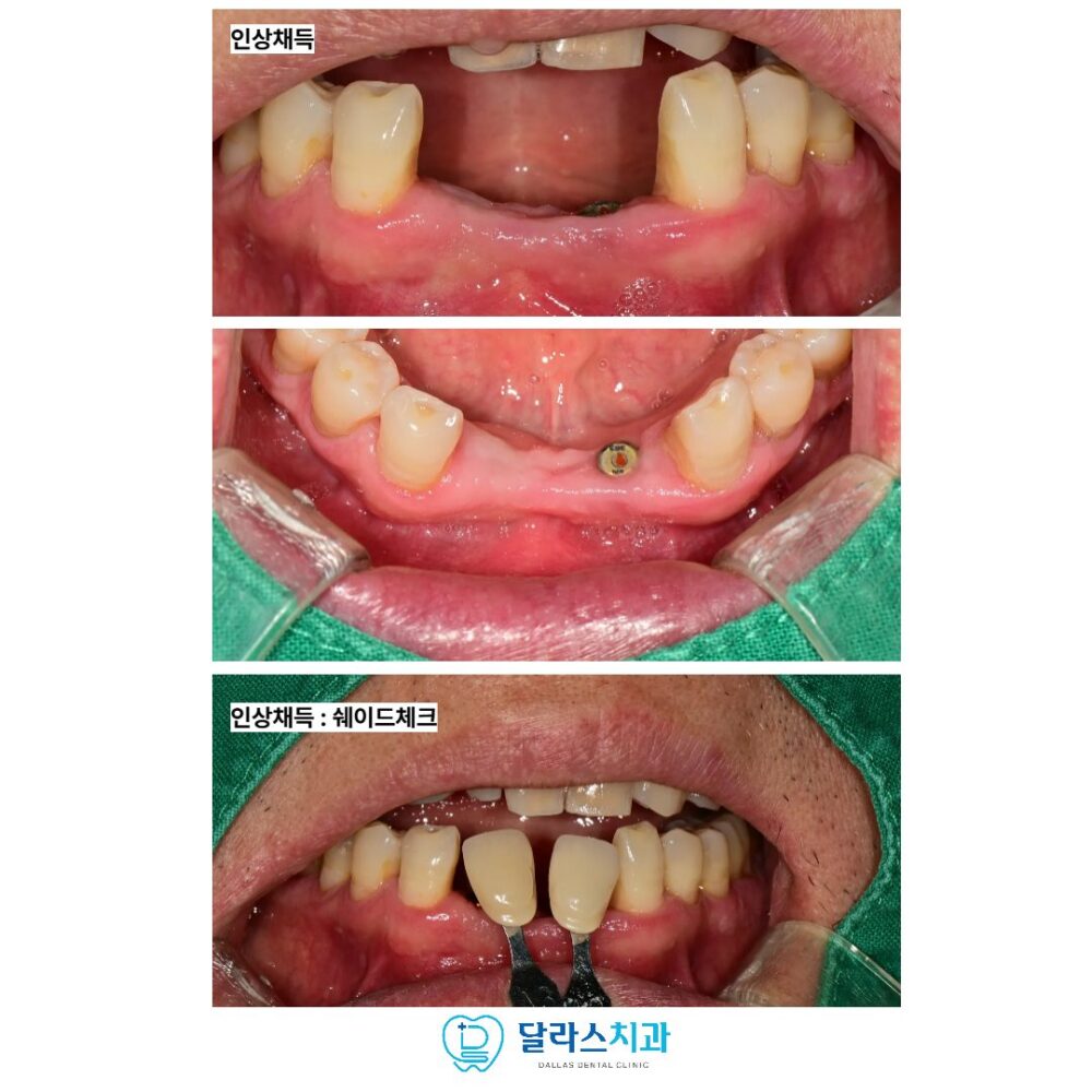 노원역치과