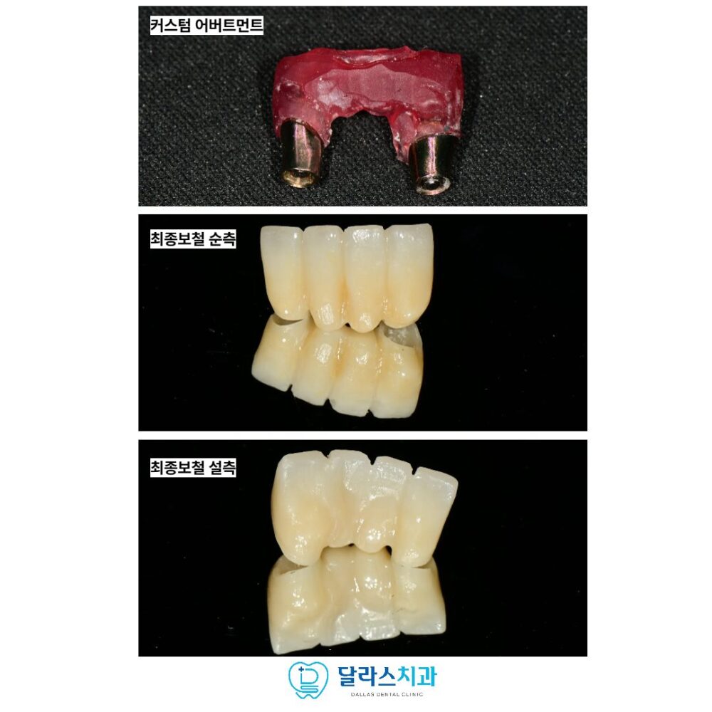 노원역치과