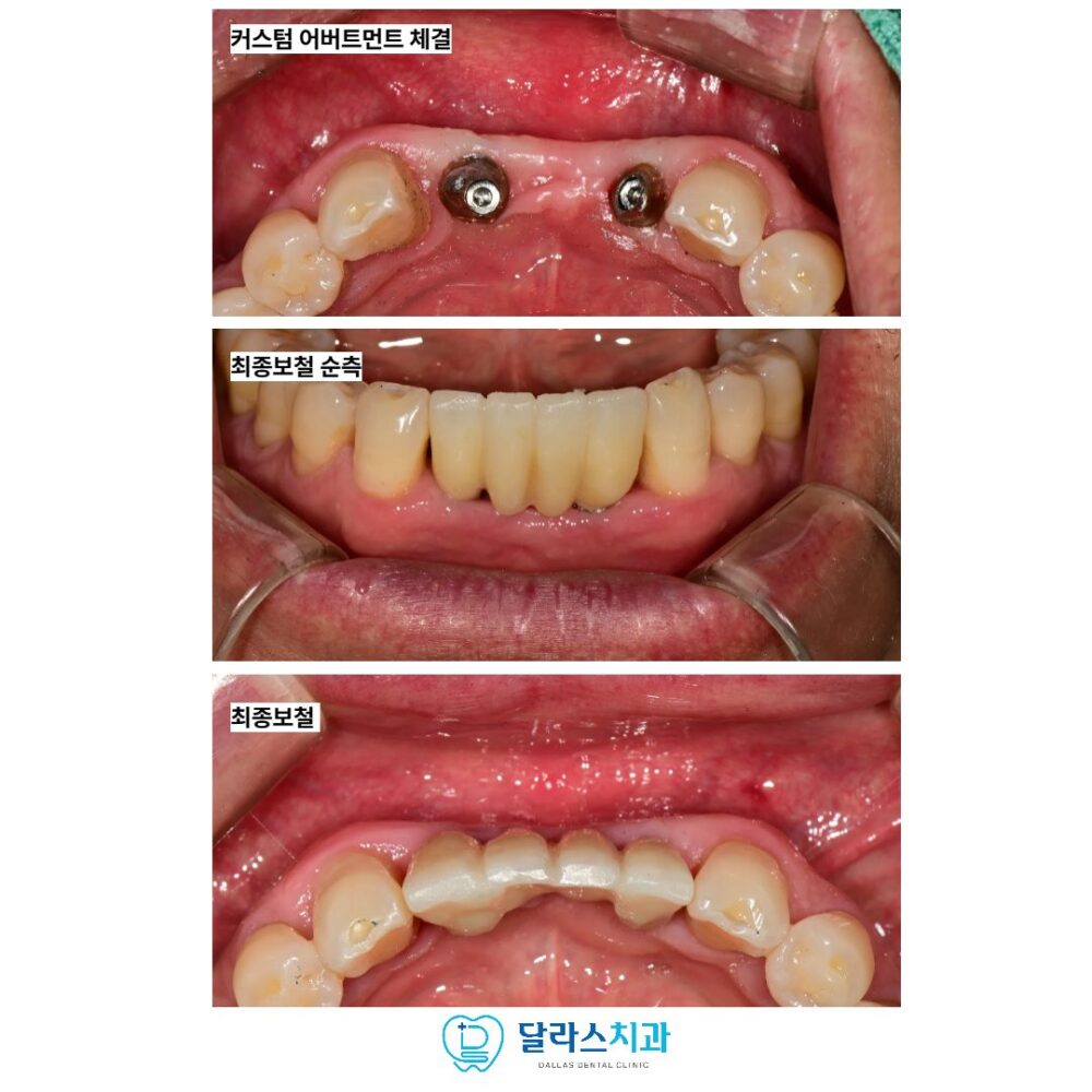 노원역치과