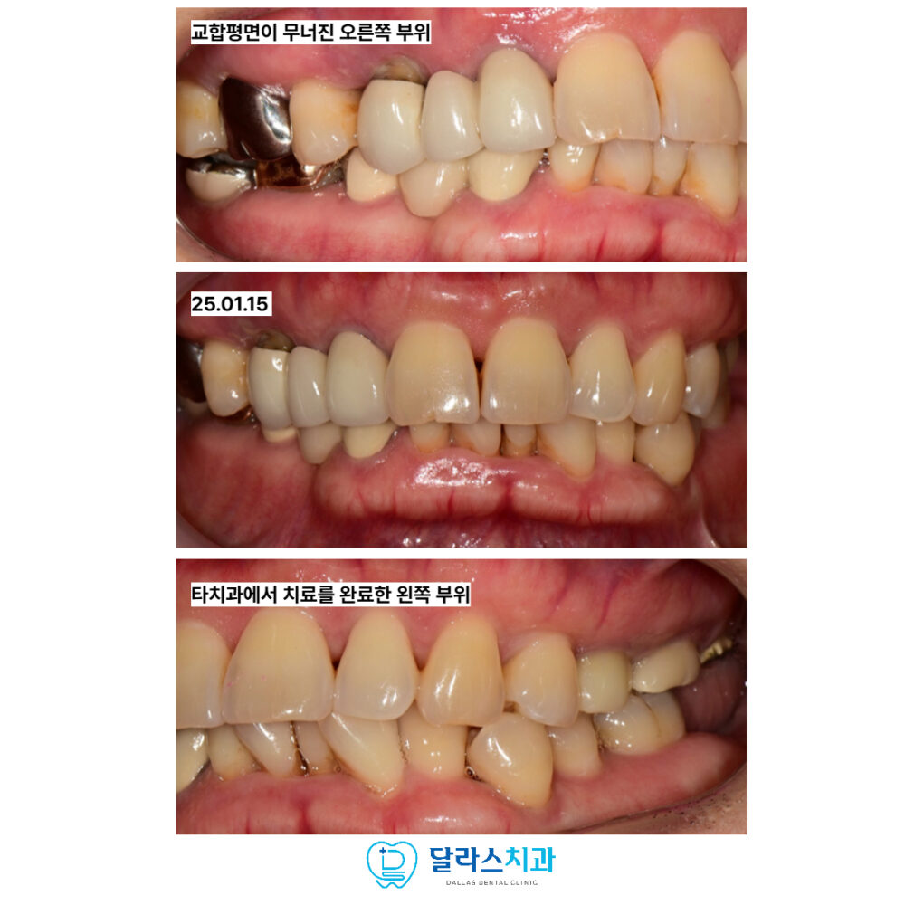 노원역임플란트