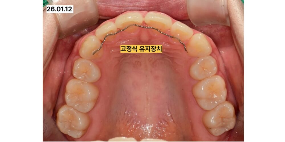 노원치과