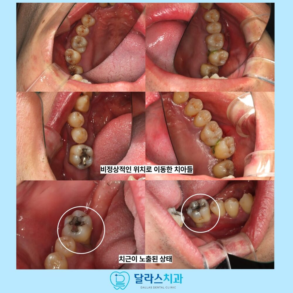 노원치과