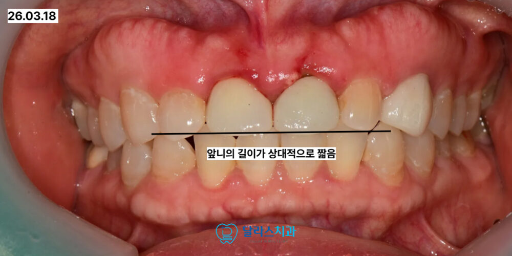 노원치과