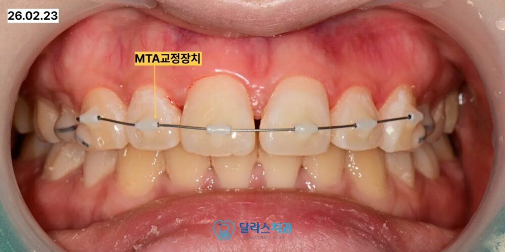 노원치과