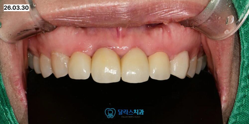 노원치과